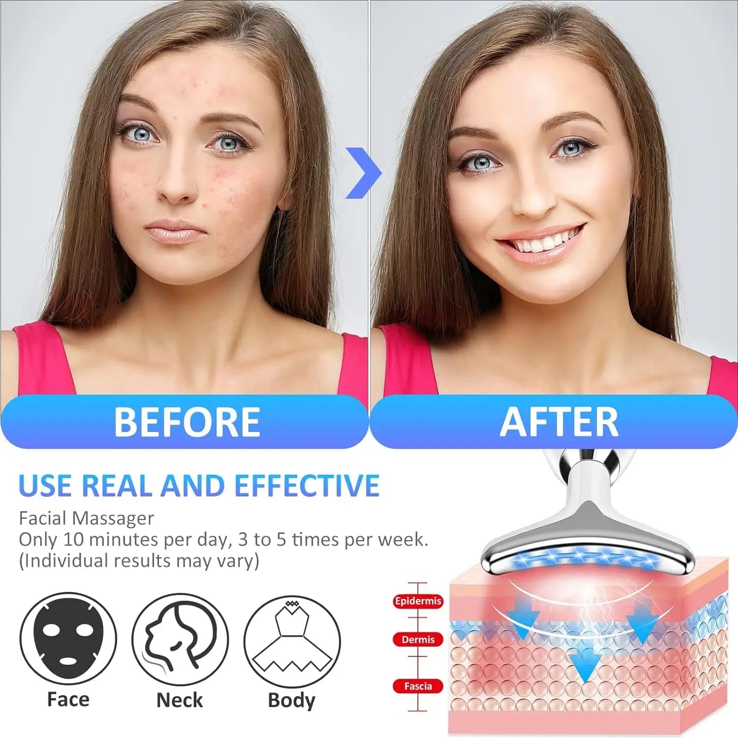 Neck Facial Lifting Device – Skin Tightening & Anti-Wrinkle - DUX