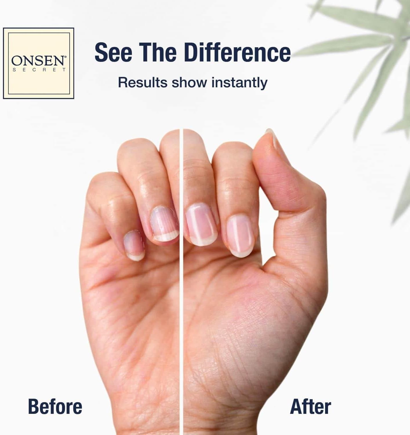 Onsen Secret Essential Nail Reboot Kit - DUX