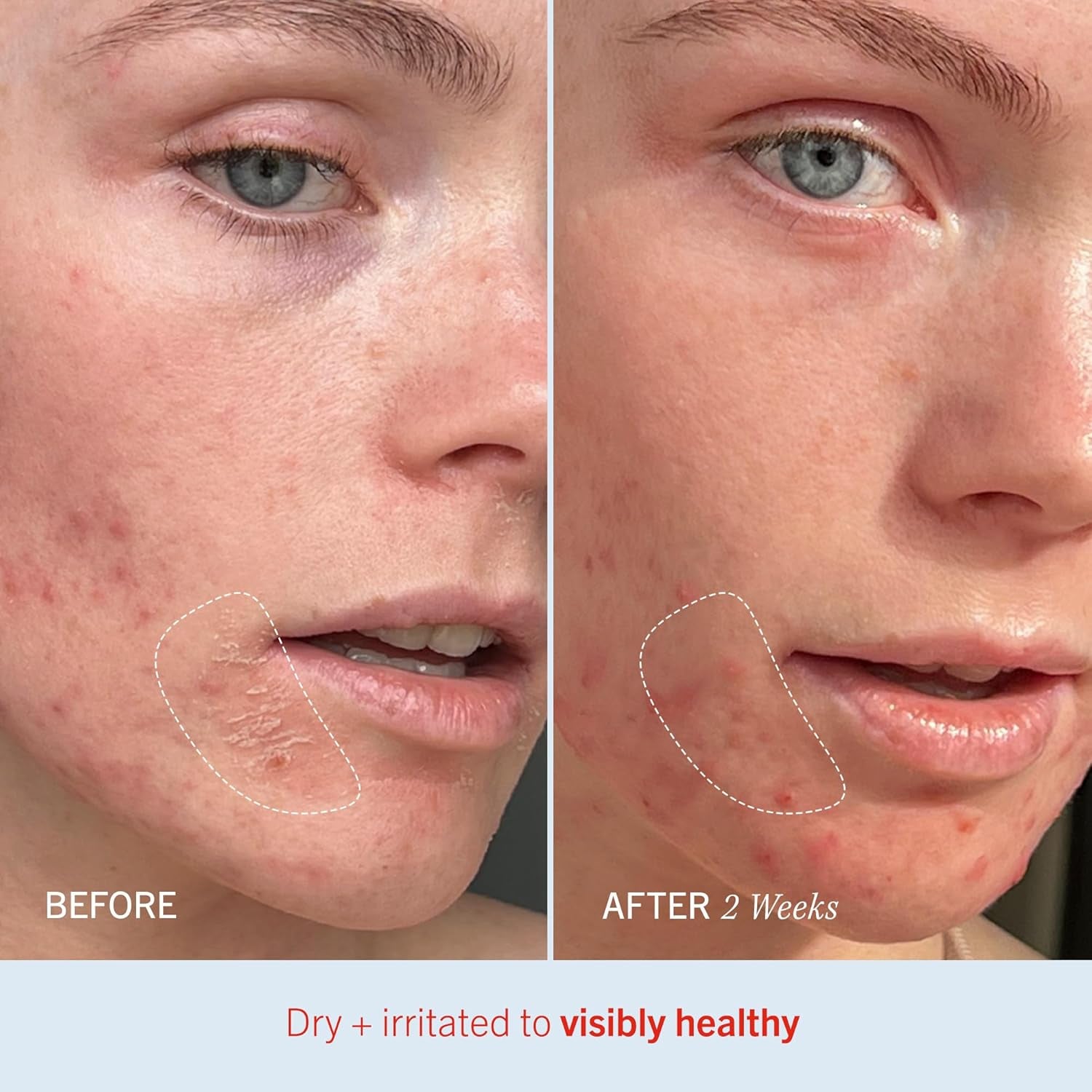 Ultra Repair Cream Intensive Hydration Daily Moisturiser for Face + Body - DUX