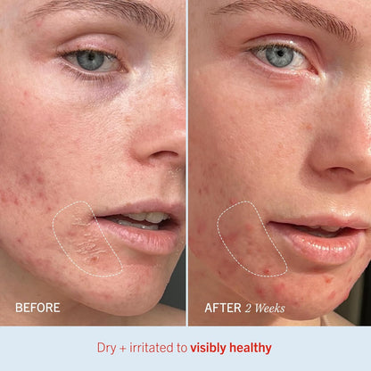 Ultra Repair Cream Intensive Hydration Daily Moisturiser for Face + Body - DUX